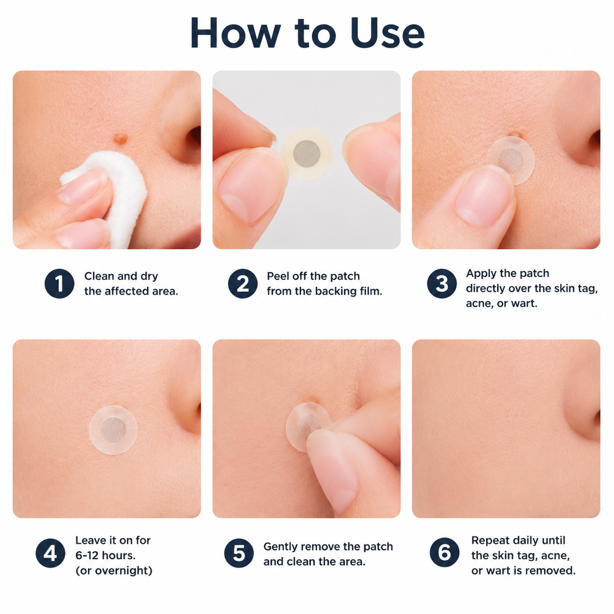 ✨2-in-1 Microneedle & Hydrocolloid Patch🍀| Removes Raised Moles, Acne, Flat Warts & Skin Tags | Helps Improve Wrinkles, Scars & Blemishes | Invisible Patches for Face & Body-YH