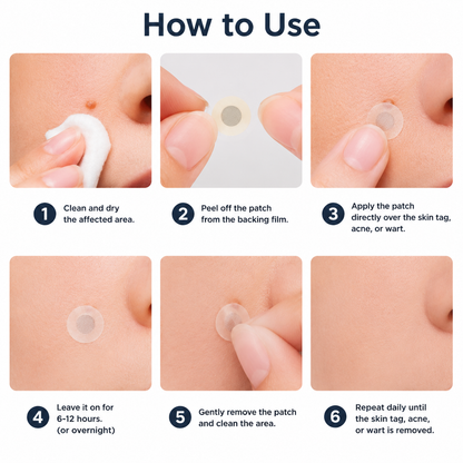 ✨2-in-1 Microneedle & Hydrocolloid Patch🍀| Removes Raised Moles, Acne, Flat Warts & Skin Tags | Helps Improve Wrinkles, Scars & Blemishes | Invisible Patches for Face & Body-YH