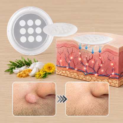 ✨2-in-1 Microneedle & Hydrocolloid Patch🍀| Removes Raised Moles, Acne, Flat Warts & Skin Tags | Helps Improve Wrinkles, Scars & Blemishes | Invisible Patches for Face & Body-YH