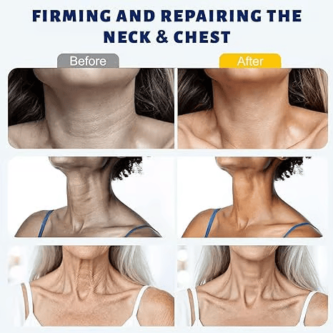 ✨ Instant Neck Lift Cream  — 🧴 Infused with Retinol & Hyaluronic Acid | Firms the Neck, Reduces Wrinkles & Double Chin -$AC