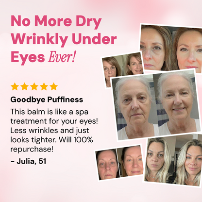 Revive Tired Eyes – Hydrating & Anti-Wrinkle Eye Balm -WH